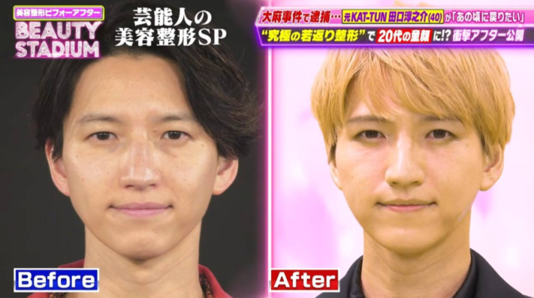 田口淳之介ビフォーアフター